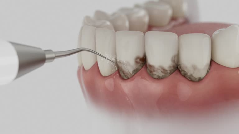 Reliable Dental contractor in Lexington Hills, CA by Dentist Open Now